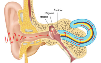 Otosclerose tem tratamento?