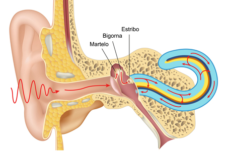 Otosclerose tem tratamento?